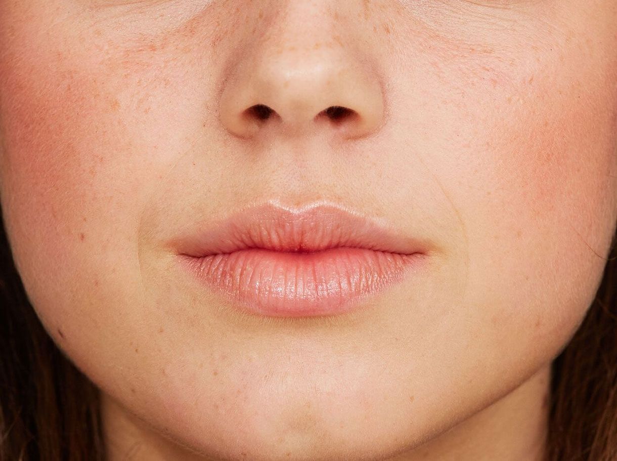 Comment obtenir de petits pores: les minimiseurs de pores et les traitements que vous devez essayer